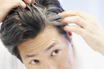 روش های جلوگیری از ریزش موی سر