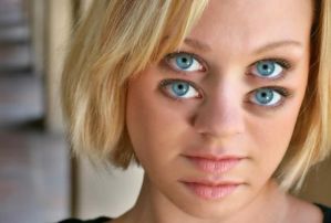 تولد دختر عجیب با دو صورت در استرالیا