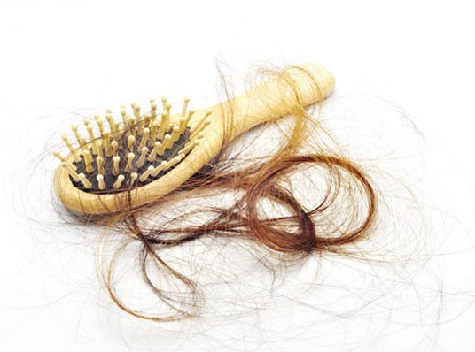 چند نکته مهم در مورد ریزش مو خانم ها